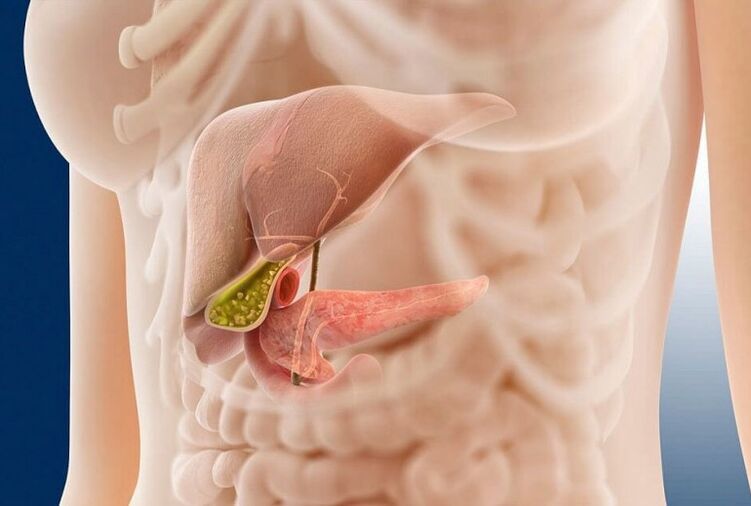 What is the pancreatitis